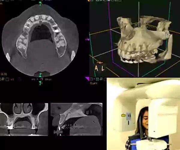علاج جذور الأسنان الموجه بالتصوير المقطعي المحوسب