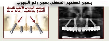 أفضل-عيادة-زراعة-أسنانعلاج-أسنان-في-جدة،-السعودية-1.jpg