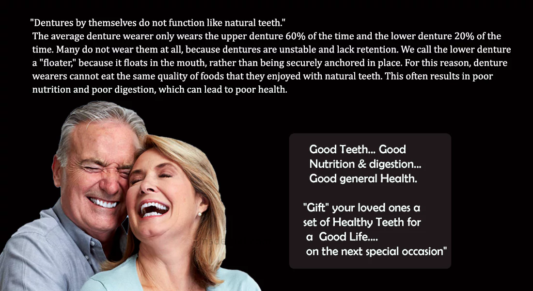 استبدال الأسنان الكامل