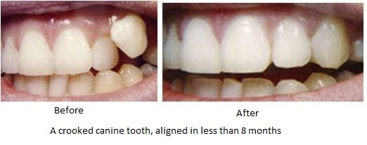 العلاج التجميلي للفم الكامل